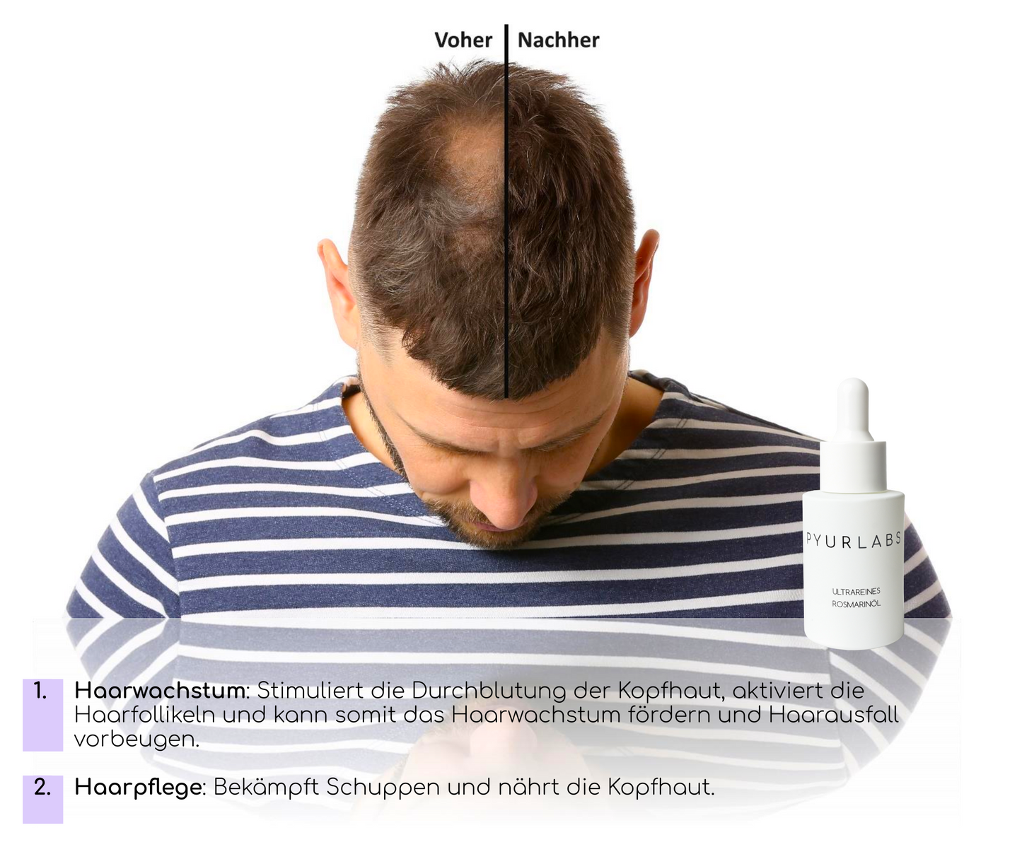 Ultrareines Rosmarinöl | Ph. Eur. | stimuliert Haarwachstum - stoppt Haarausfall